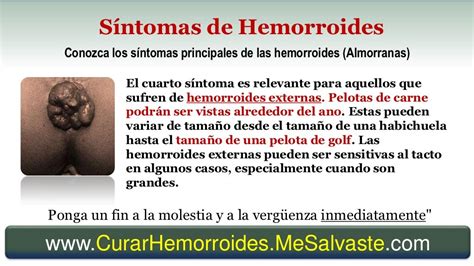 hemorroides externas fotos|Hemorroides o almorranas: tipos, tratamientos y fotos